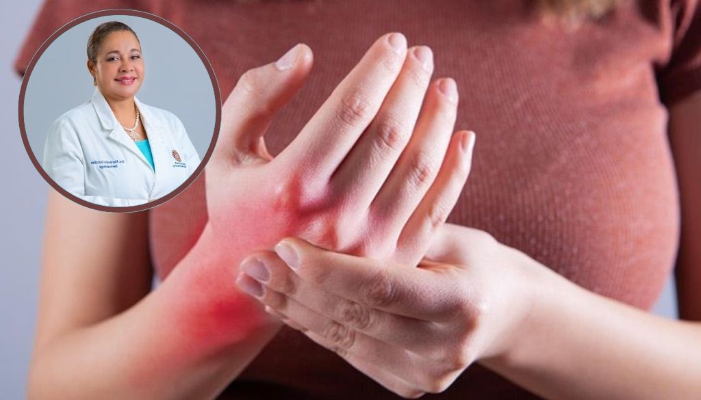 Hagamos visible el Lupus: enfermedad que afecta a millones en el mundo 