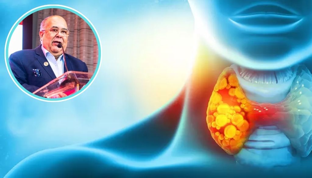 ¡Alerta! Aumento en cáncer de tiroides preocupa especialistas 