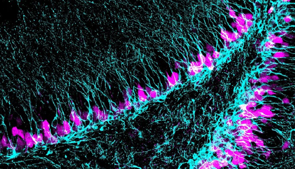 Descubren un gen clave para regeneración cerebral en la adultez 
