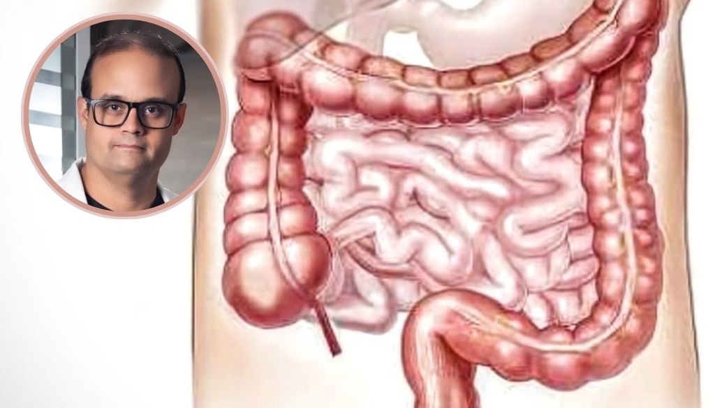Diverticulitis: enfermedad frecuente que puede prevenirse con hábitos saludables 
